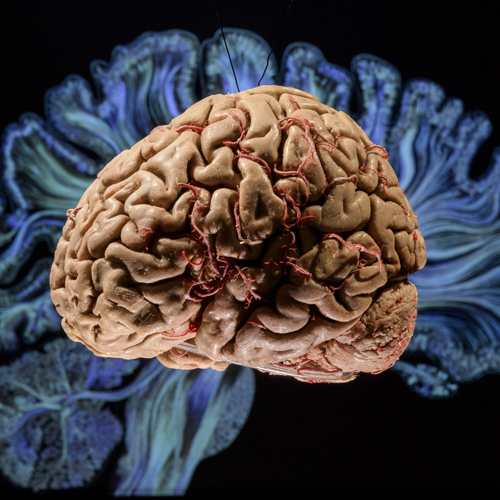 Exposição Cérebro – mais vasto que o céu